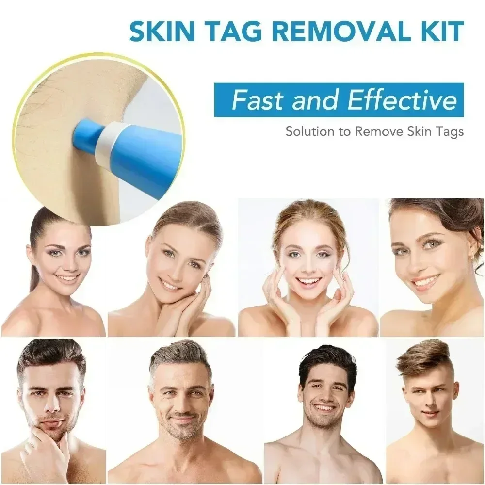 2 IN 1 Painless Auto Micro Skin Tag Removal Kit Adult Skin Tag Mole Wart Remover Device Face Cleaning Skin Care Beauty Tools photo 3