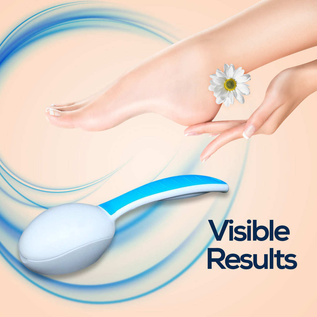 Foot Care Set - Callus Remover, Heel File & Ergonomic Handle Bu Nas L photo 3