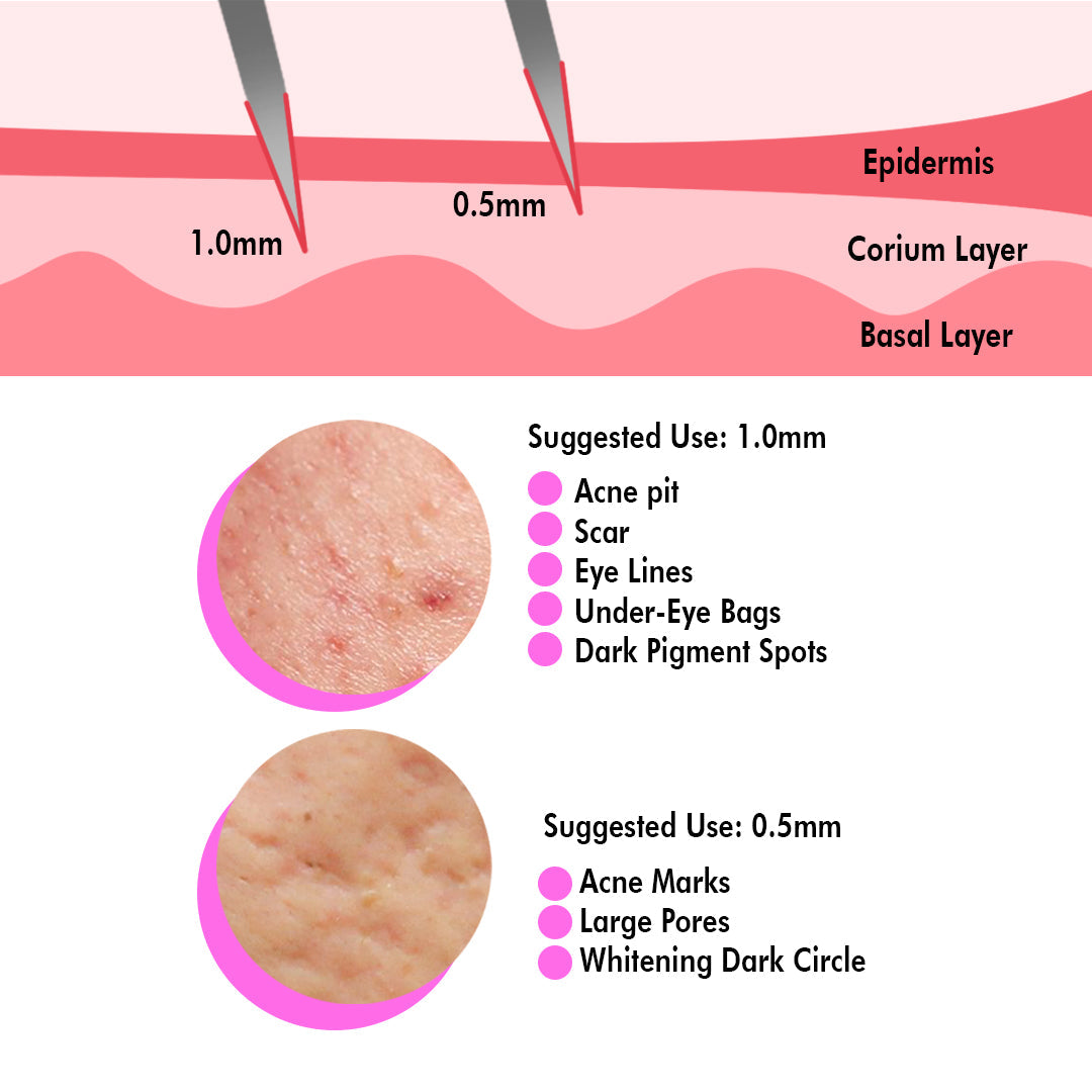 0.5 MM Dermaroller 540 Titanium Micro Needle Roller photo 3