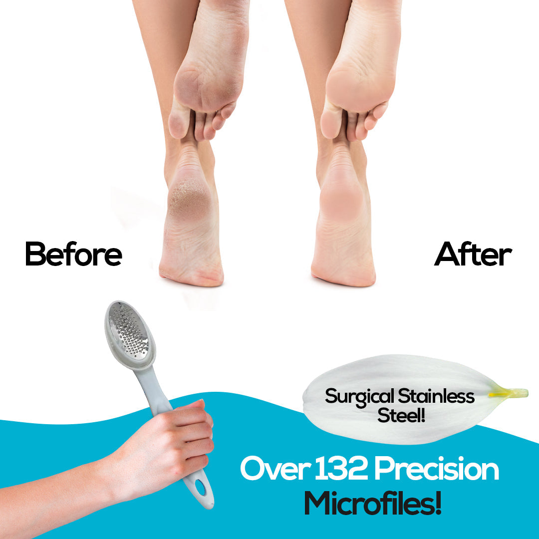 Foot Care Set - Callus Remover, Heel File & Ergonomic Handle Bu Nas L photo 5
