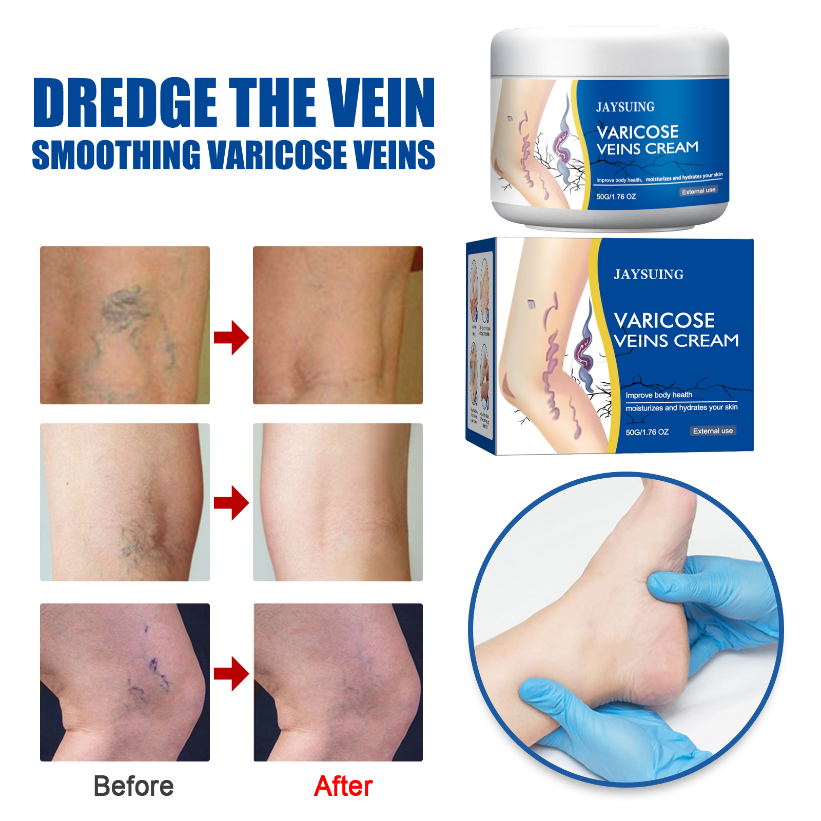 Leg Care Cream 50g 1box photo 2
