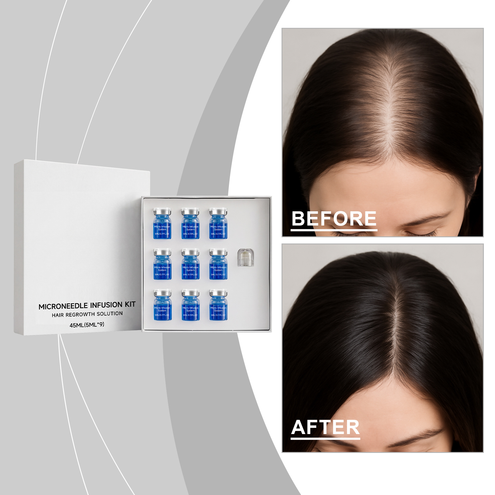Scalp Serum Microneedle Kit 45ml-box photo 7