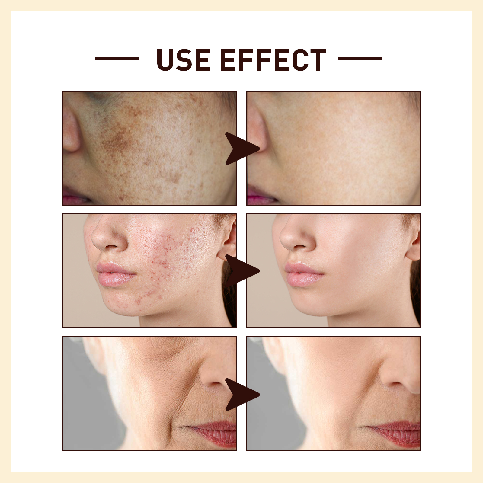OUHOE Rice Anti Wrinkle Essence, Repairs Skin Moisturizes Firms Whitens photo 7