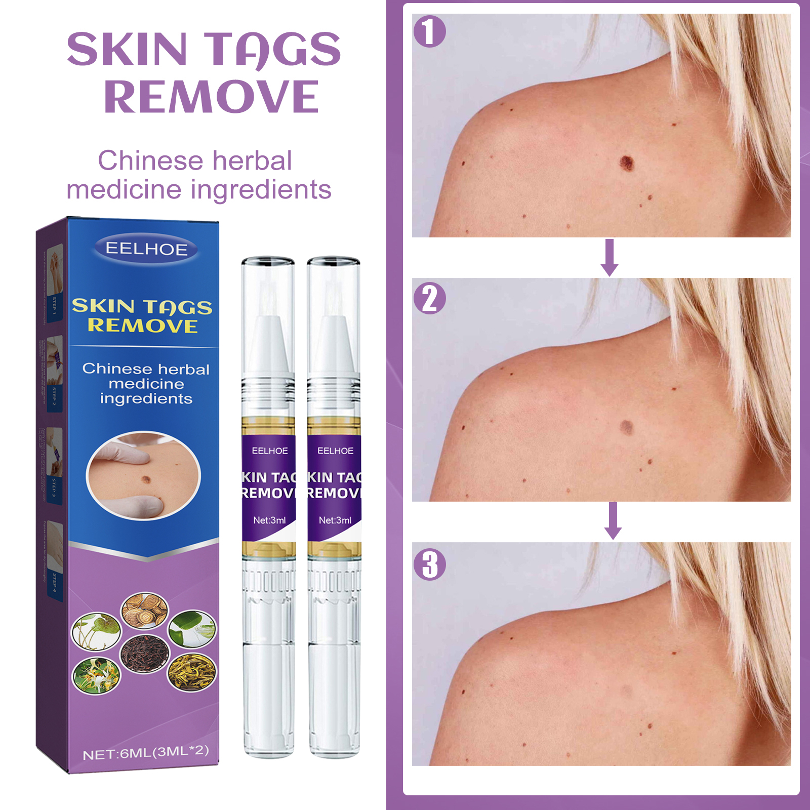 Skin Care Pen 3ml 1box photo 5