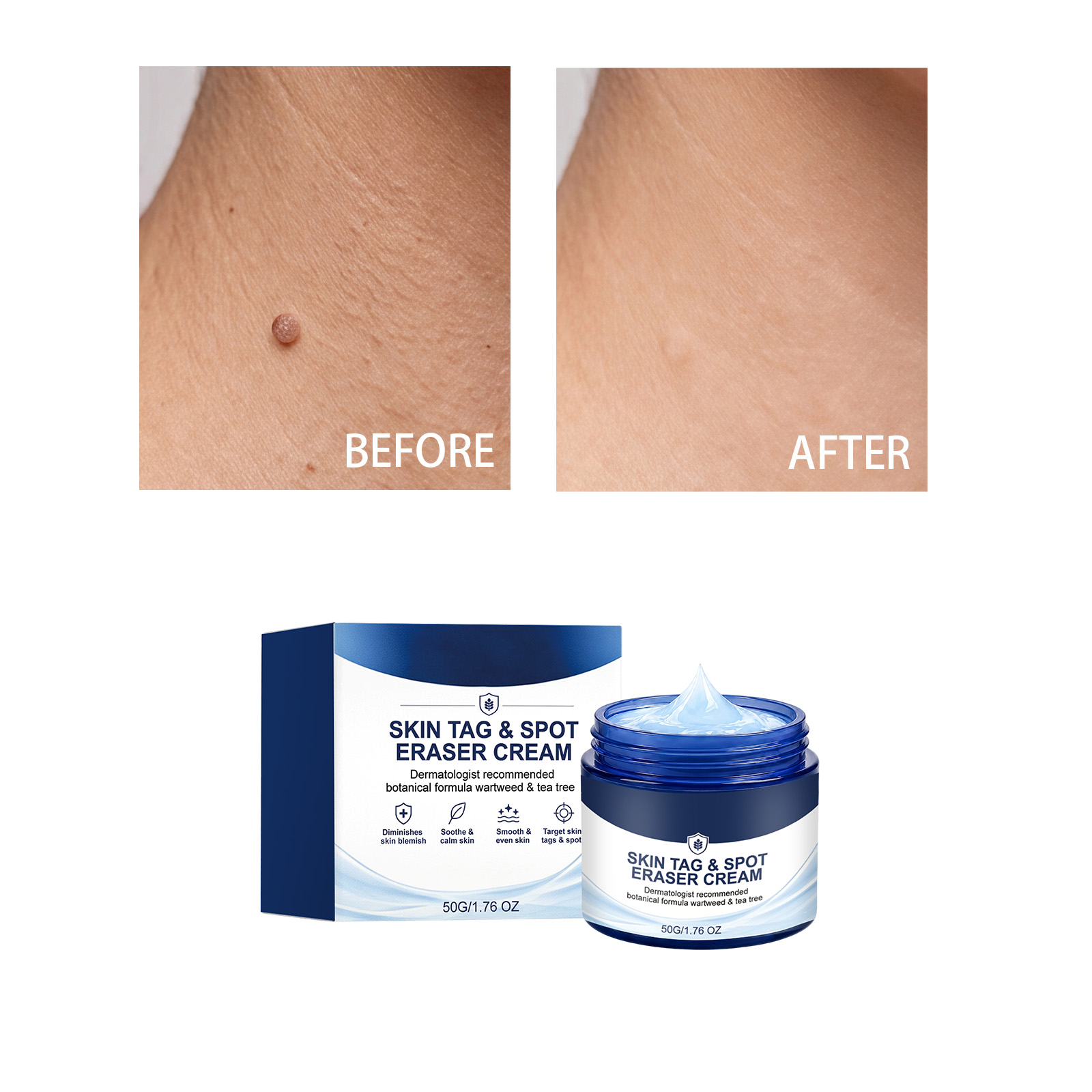 Skin Care Cream 30g 1box photo 5