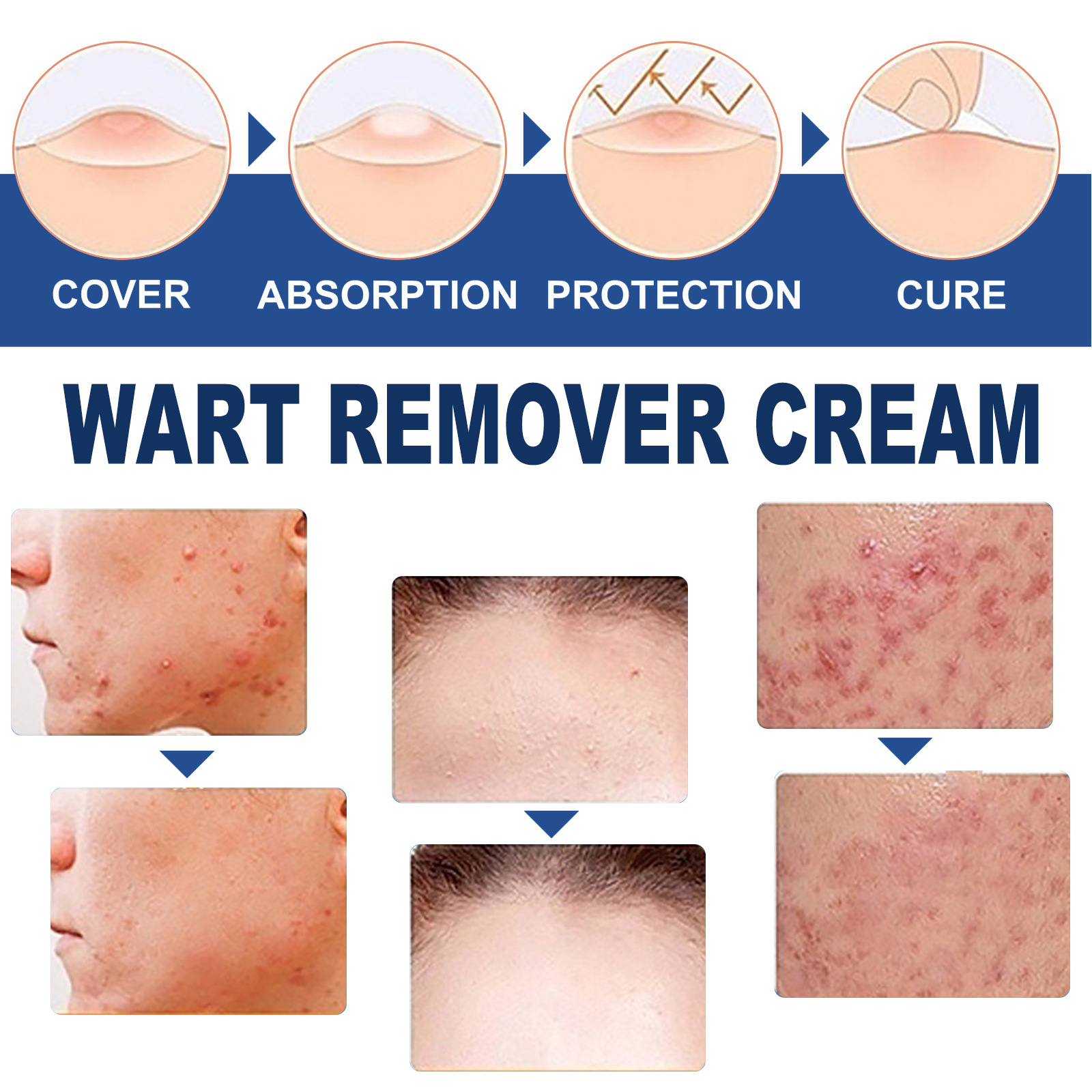 Skin Smoothing Cream 20g 1box photo 5