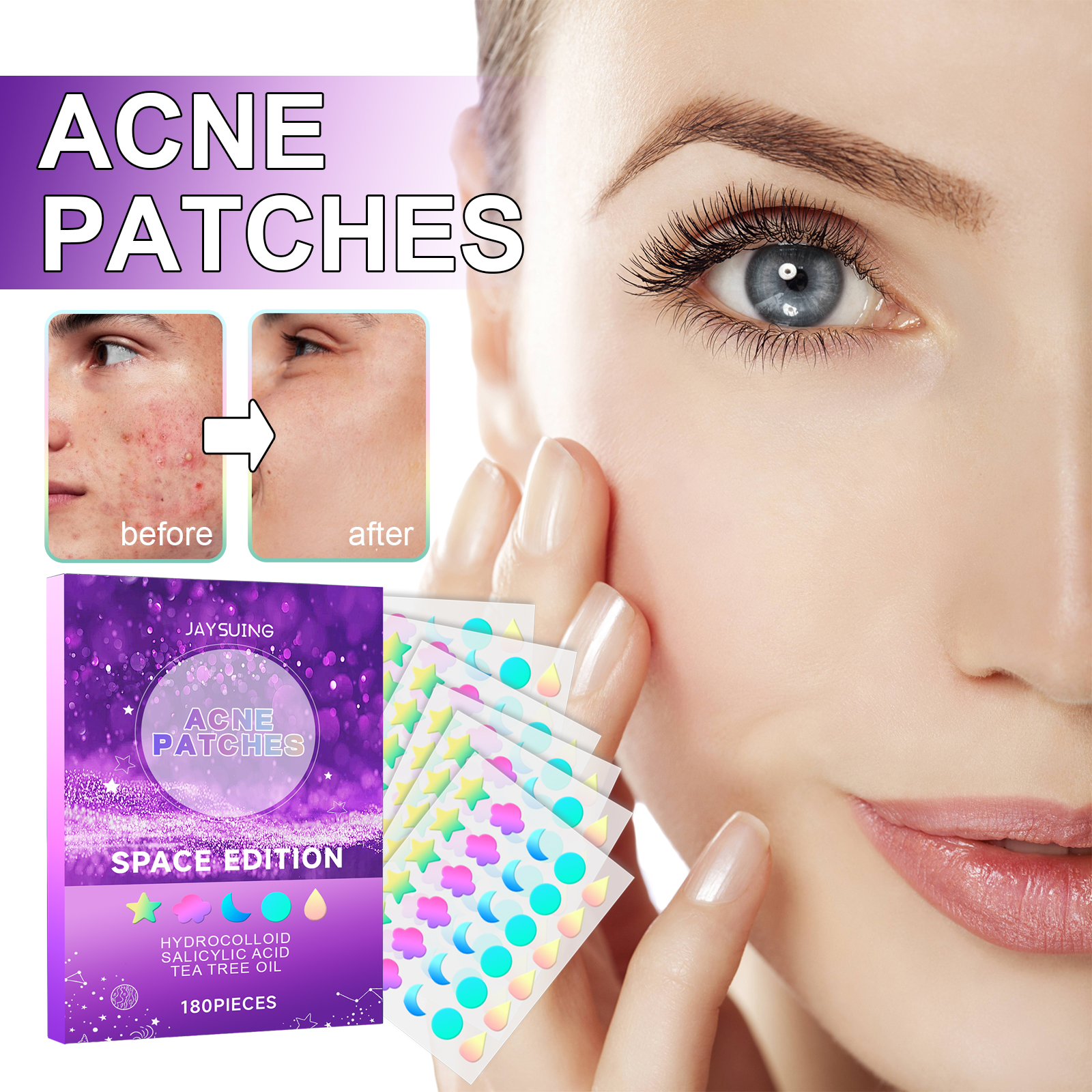 Jaysuing Acne Patches, Lightening Facial Acne Pimples Closed Repair Balance Skin Delicate Pore Care photo 8