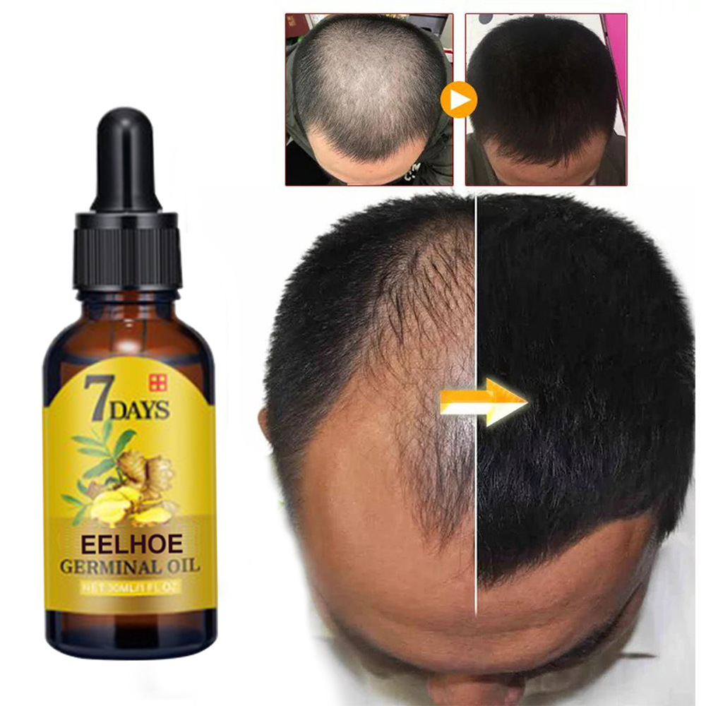 Ginger Hair Liquid 20ml 1box photo 5