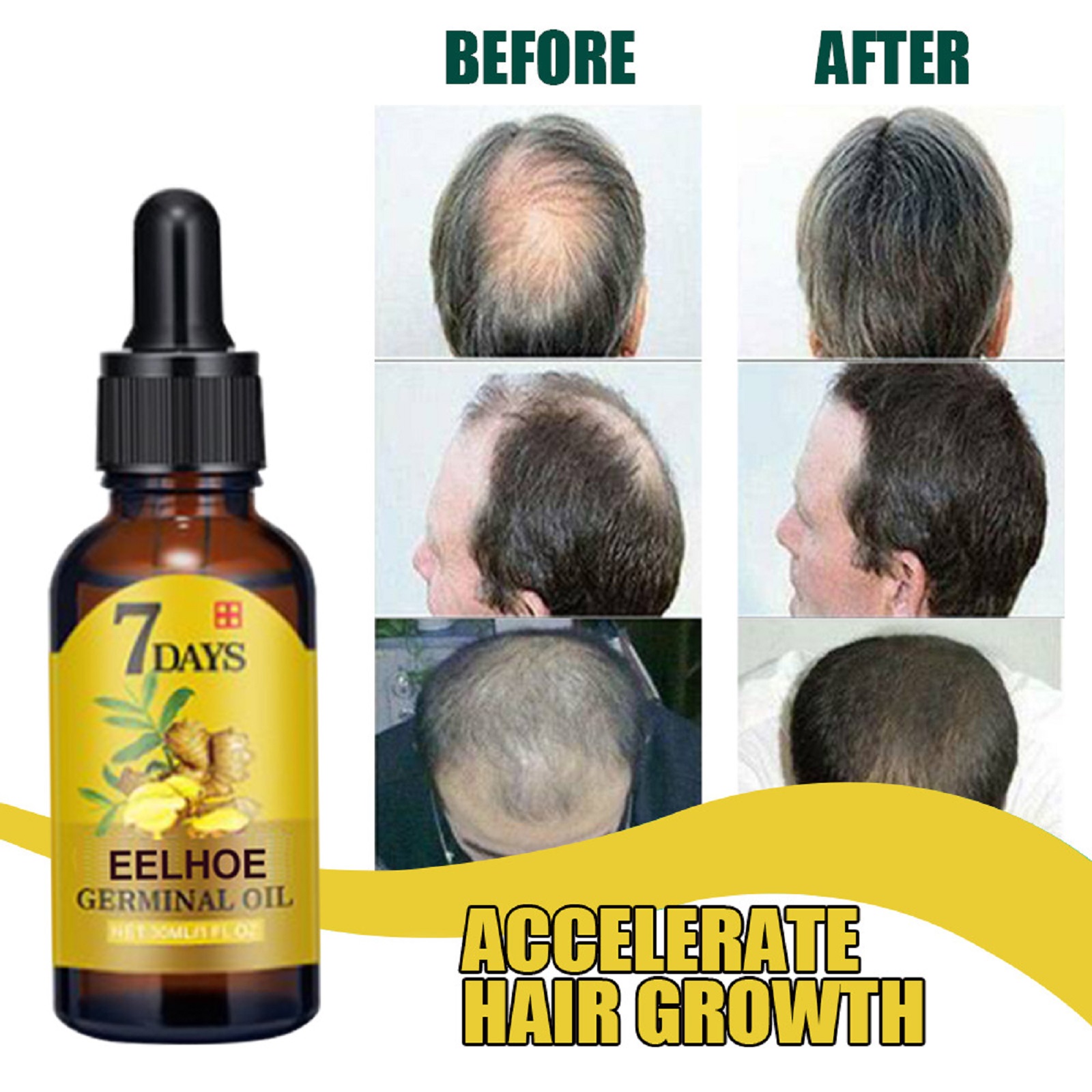 Ginger Hair Liquid 20ml 1box photo 8