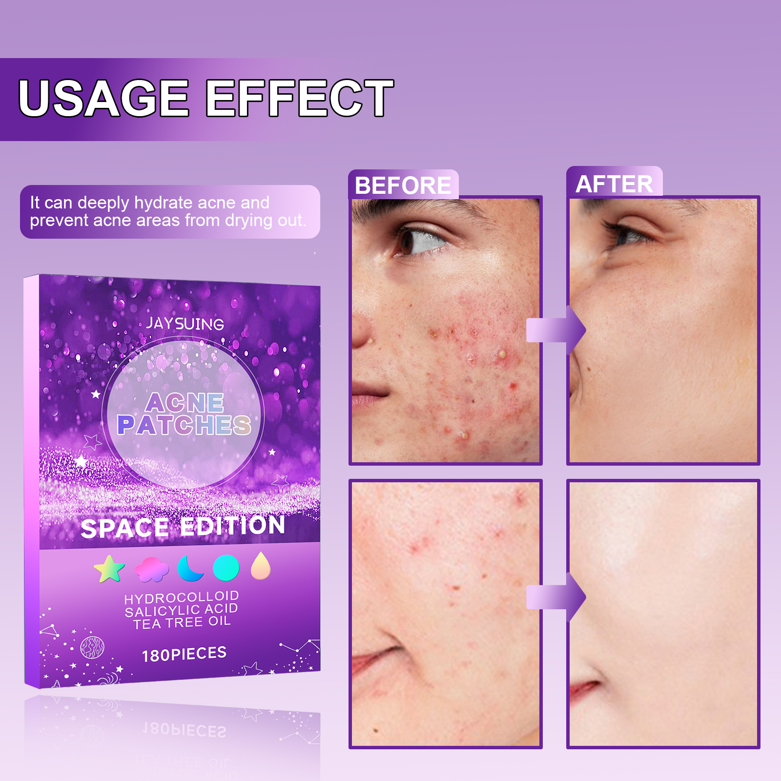 Jaysuing Acne Patches, Lightening Facial Acne Pimples Closed Repair Balance Skin Delicate Pore Care photo 2