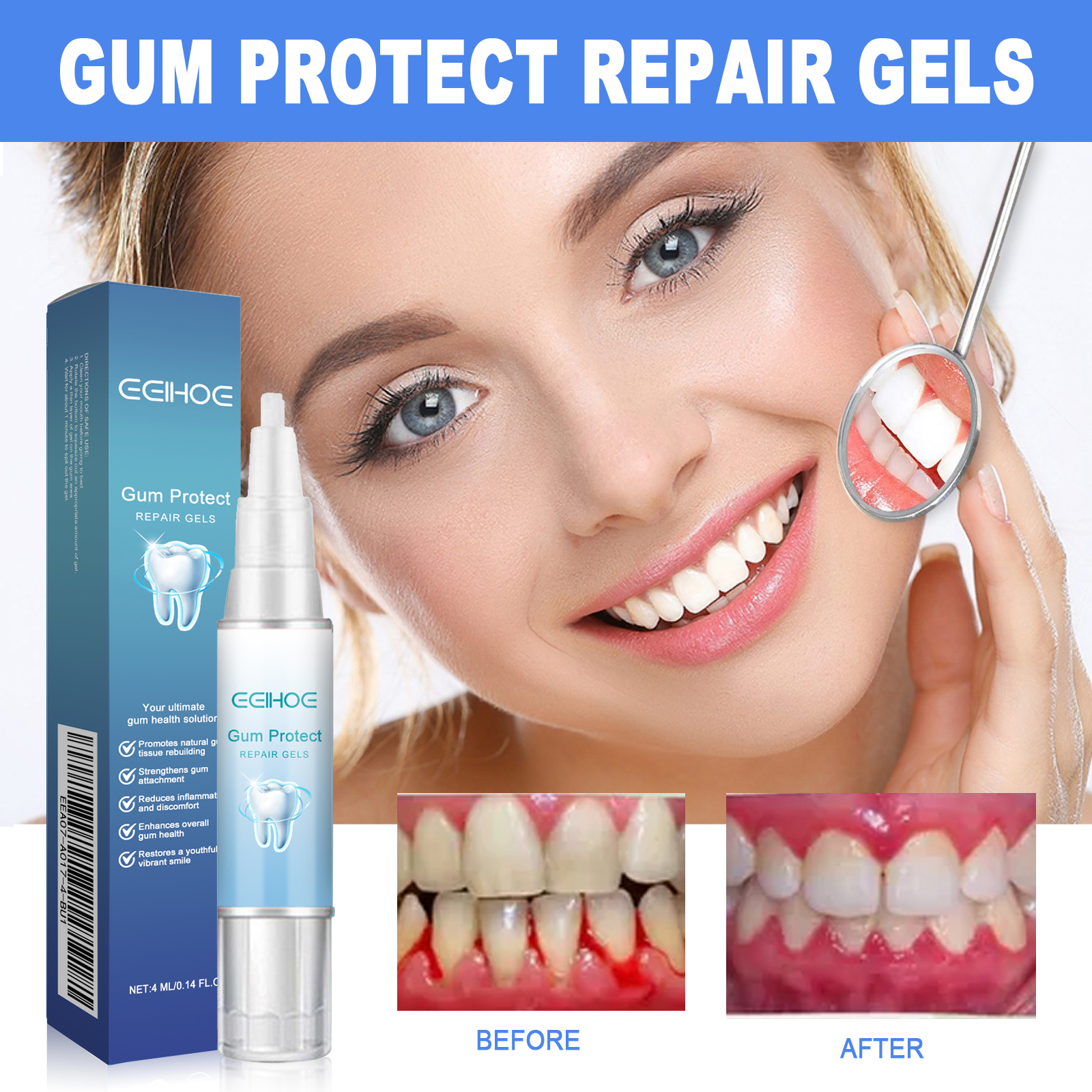 Dental Soothing Gel 4ml 1box photo 3