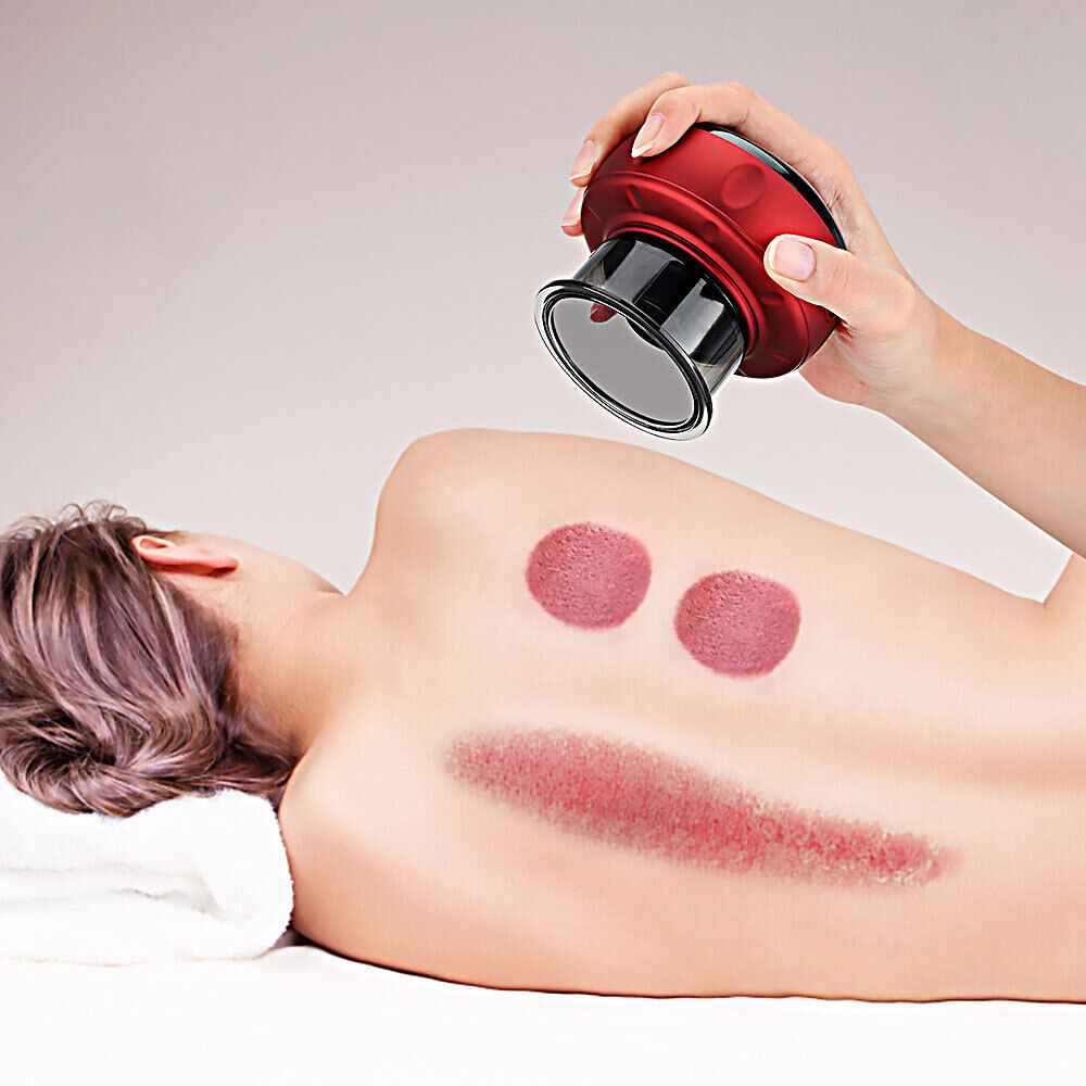 12Level Red Electric Cupping Therapy Smart Red Light Heating Massager photo 4