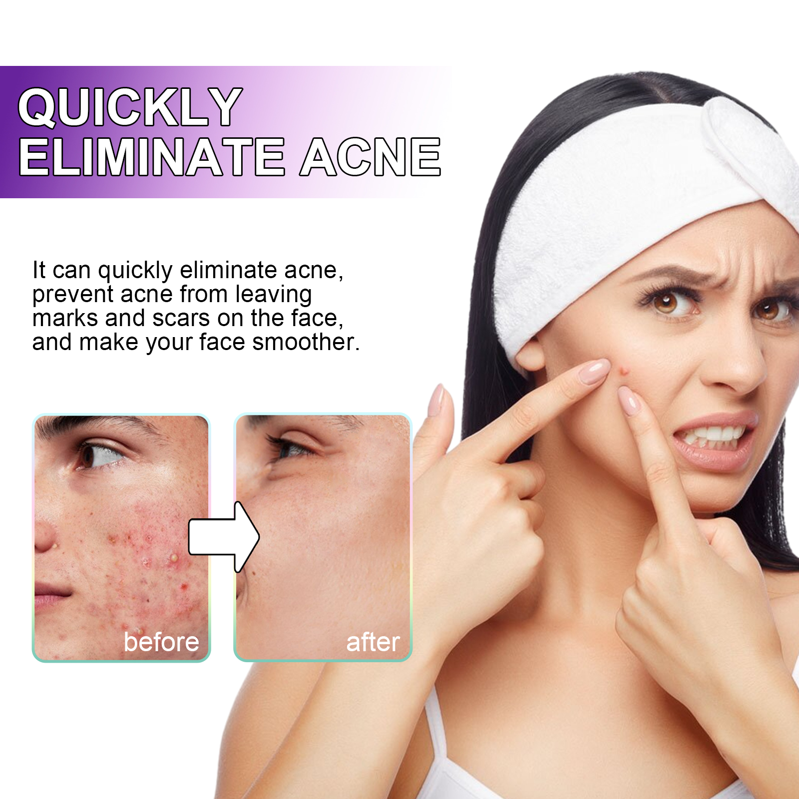 Jaysuing Acne Patches, Lightening Facial Acne Pimples Closed Repair Balance Skin Delicate Pore Care photo 3