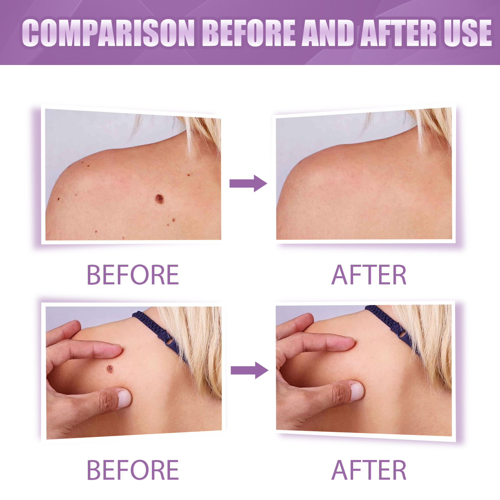 Skin Care Pen 3ml 1box photo 2