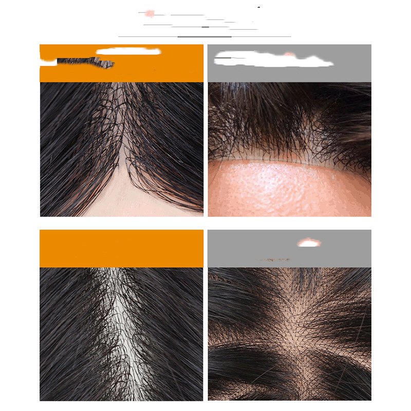Breathable Bio Scalp Bionic Film Men's Real Hair Replacement Block photo 4